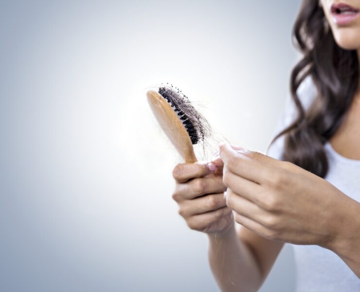 Hair falling after contracting Covid-19 or due to Stress? Reason & Remedy