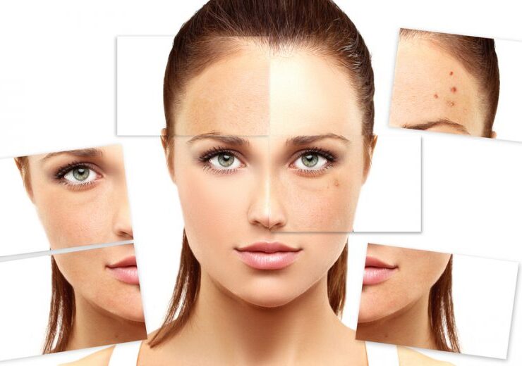 home remedy for skin tanning - natural method of getting fair & glowing skin