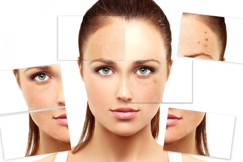 home remedy for skin tanning - natural method of getting fair & glowing skin